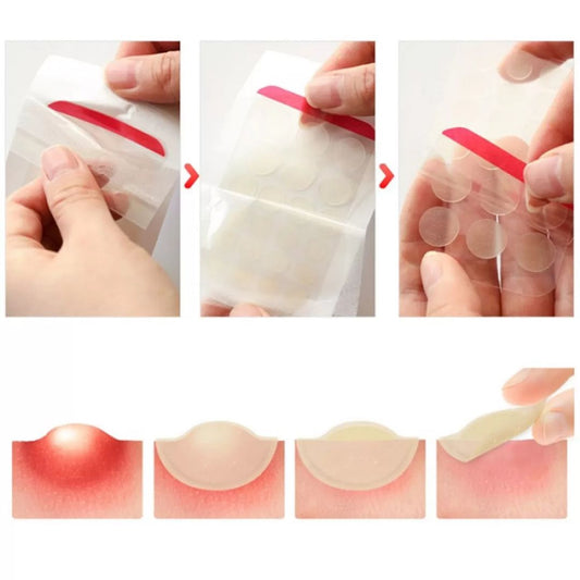 Elizavecca Witch Piggy Hell Pore Blemish Spot Patch