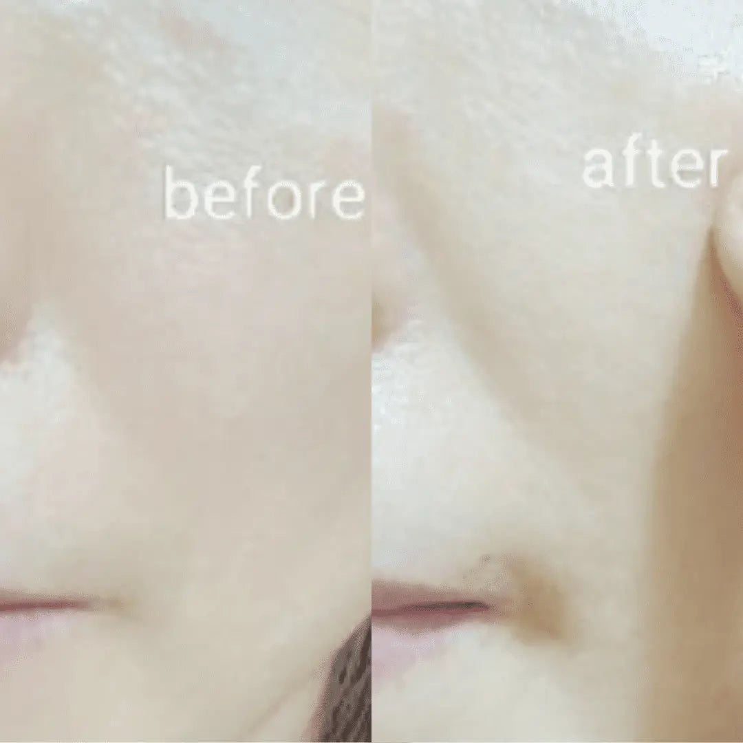 Ja Yeon Mapping Collagen Anti-Aging Mask (Wholesale) MiessentialStore