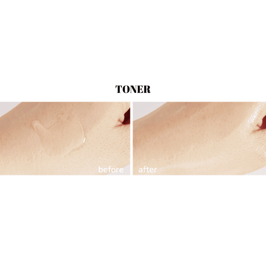 Jant Blanc Witch Hazel Natural Skin Care Set - Miessential