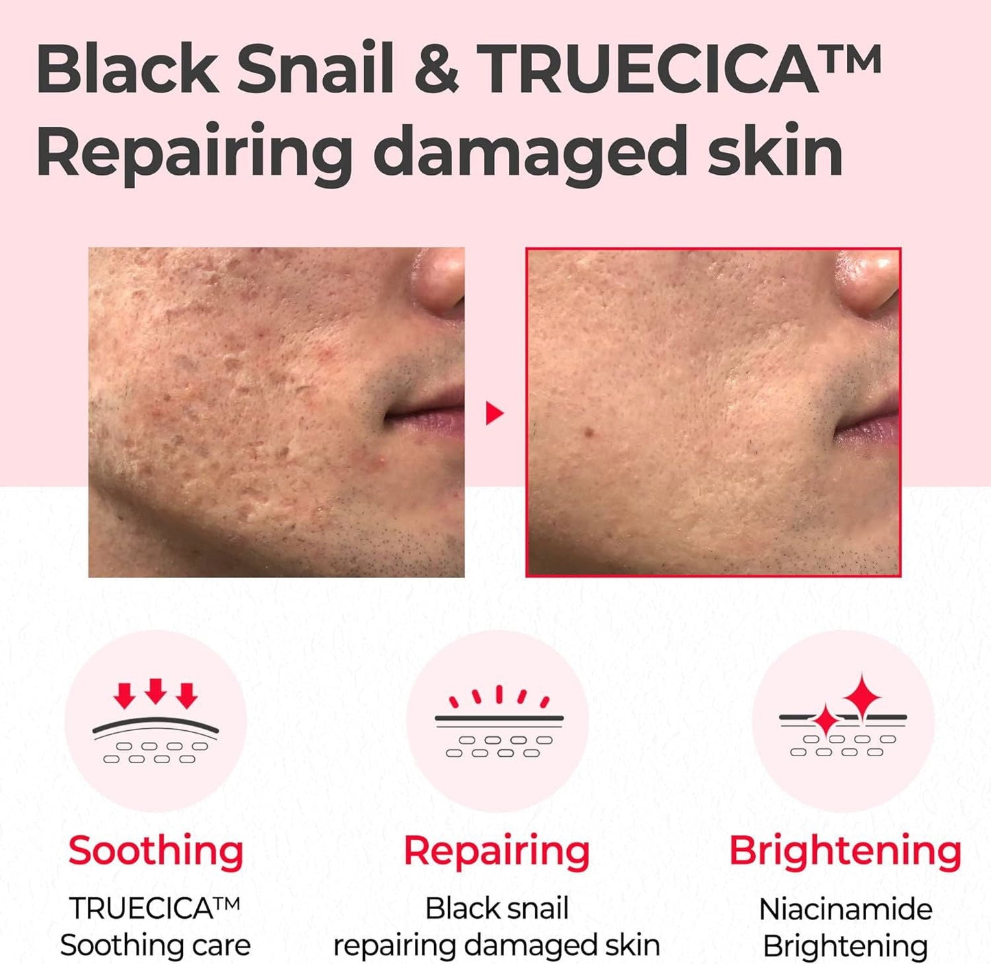 SOME BY MI Snail Truecica Miracle Repair Toner - Miessential