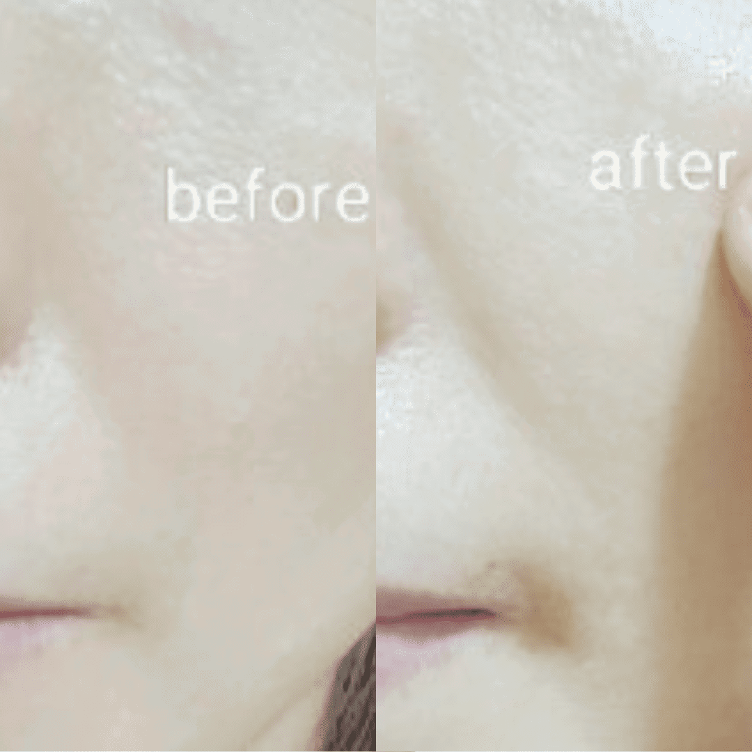 Ja Yeon Mapping Green Tea Purifying Mask (5 PCS) - Miessential