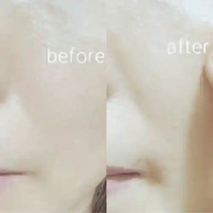 Ja Yeon Mapping White Brightening Mask (5 PCS) - Miessential