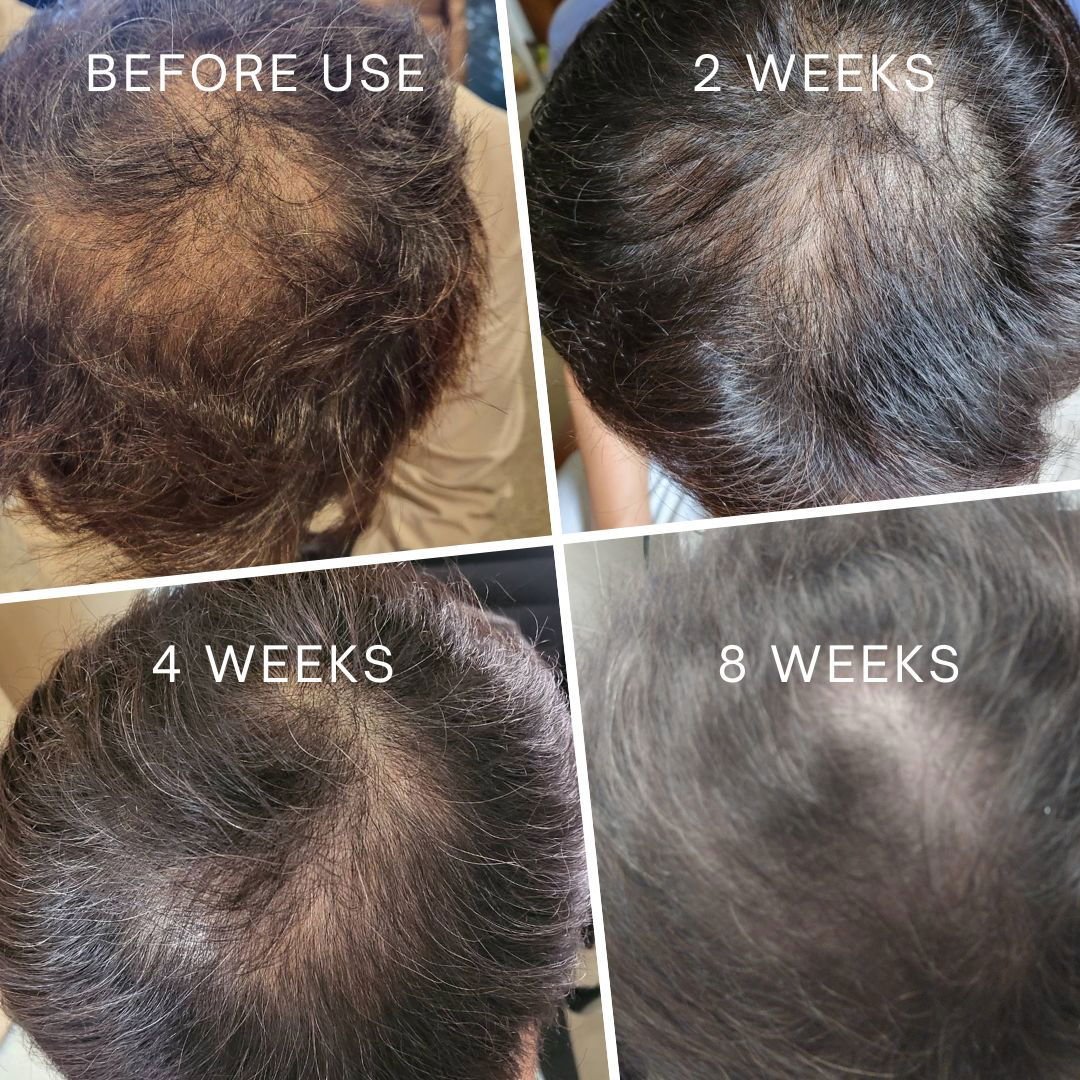 La Verne Lumiere 5α-Avocuta T Strengthening Hair Care