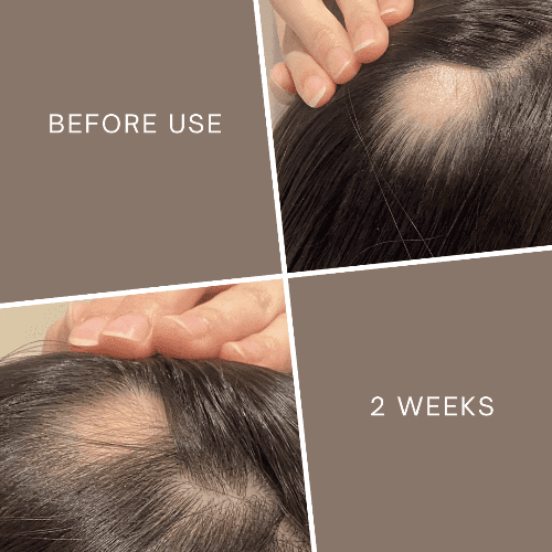 La Verne Lumiere 5α-Avocuta T Strengthening Hair Care