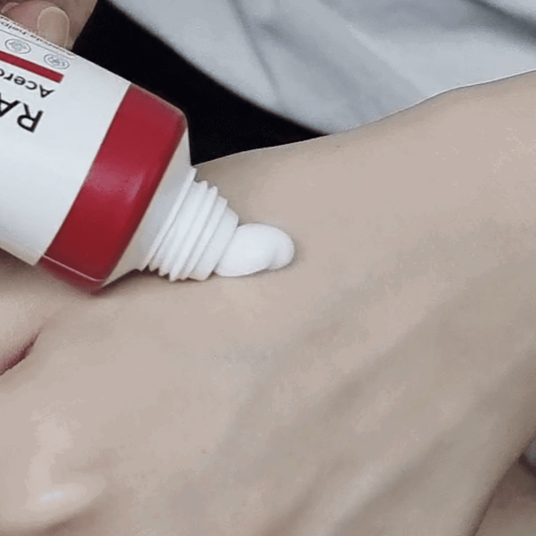 Raviel Acerola Dark Spot & Blemish Care Cream - Miessential