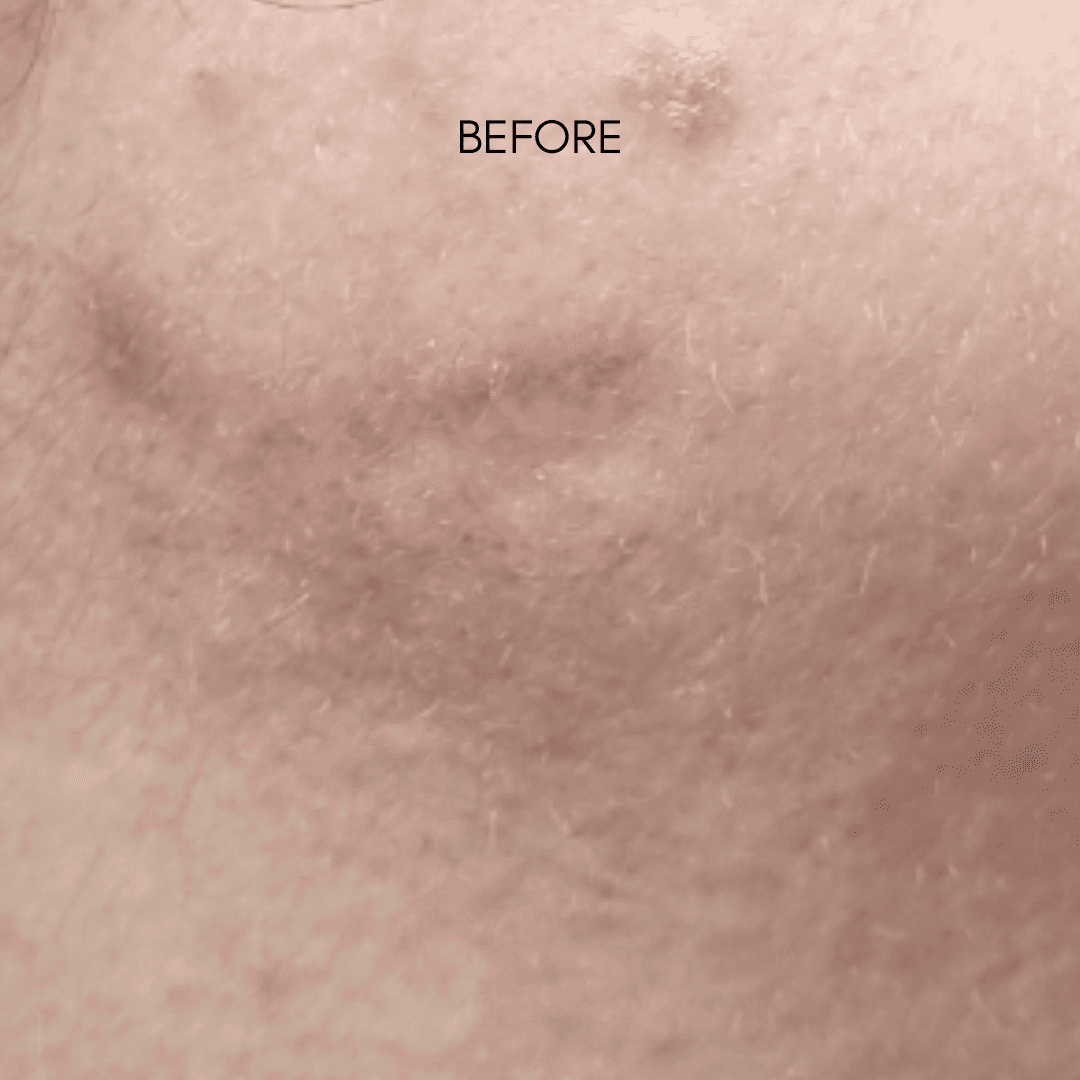 Raviel Acerola Dark Spot & Blemish Care Cream - Miessential