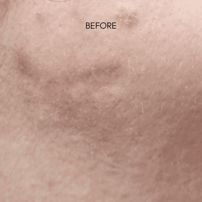 Raviel Acerola Dark Spot & Blemish Care Cream - Miessential